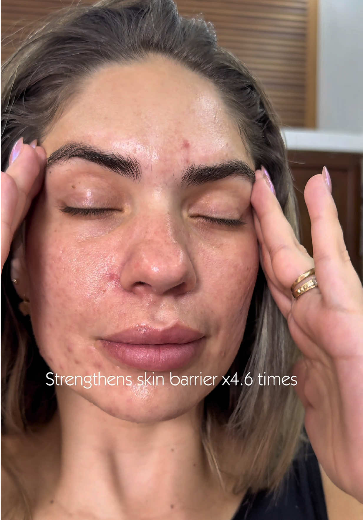 #Hwahae #Zipiderm #EGFSkinBarrierHydroAmpoule #skincare #kbeauty 