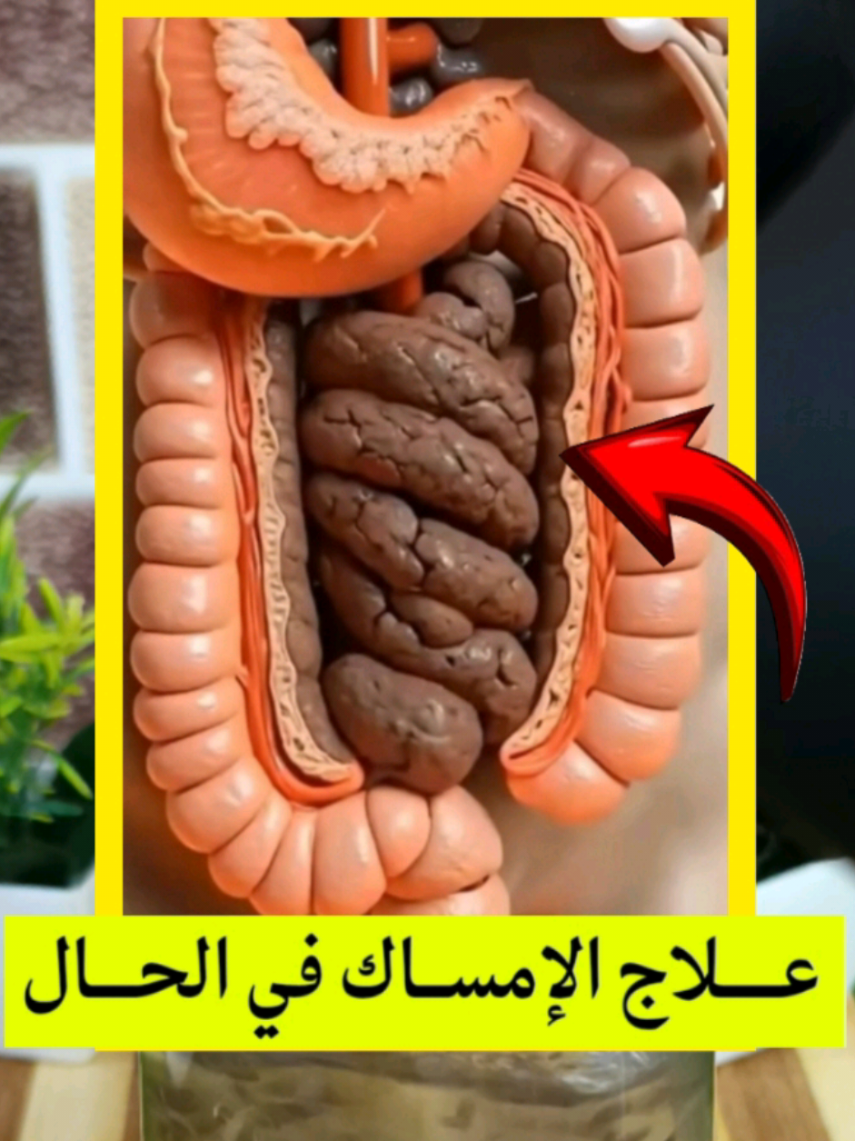 علاج الإمساك في الحال 🚨#صحتي_بالعربي #viral #صحتي #وصفة #fyp 