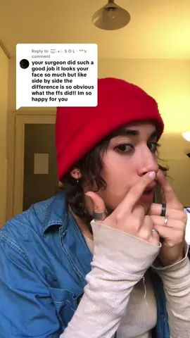 Replying to @⏤͟͟͞͞☆★☆ S O L・*° also it takes a year to heal and i’m only 3 months out #ffs 