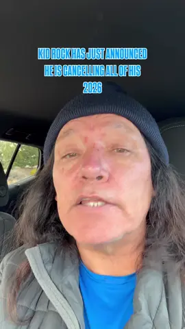 Kid Rock Who Are You Kidding #newyork #jokes #comedy #joke #comedyvideo 