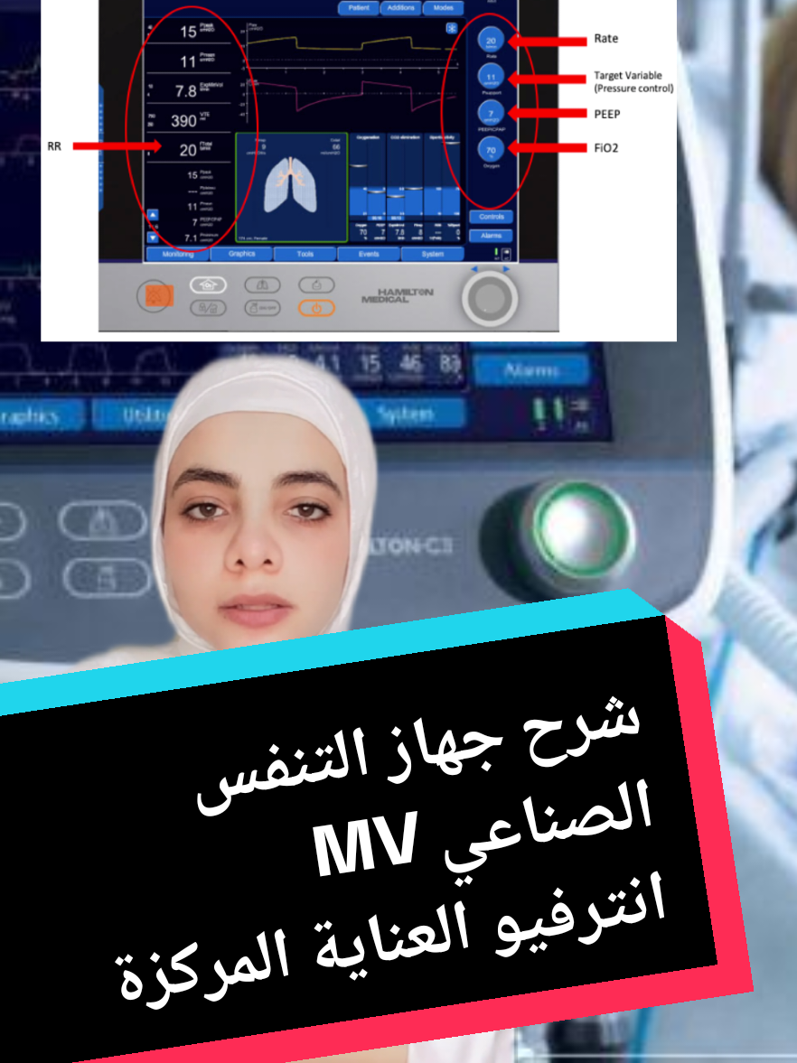 للمرة الرابعة على التوالي اعمل اديت لنفس الڤيد والتيك توك يعلق معايا 🥹واضطر ابدا من الاول  #انترفيوالعنايةالمركزةicu #كليةتمريض_معهدتمريض #الشعب_الصيني_ماله_حل😂😂 #mechanicalventilation #creatorsearchinsights2025 