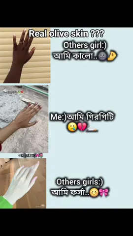 গিরগিটির মতো রং পরিবর্তন হয়🥲🌈💔#foryou #foryoupage #copylink #unfrezzmyaccount #fypシ゚ 