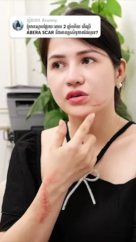 គ្រីមបំបាត់ស្នាម Abera Scar - ដំណោះស្រាយនៅផ្ទះ ជួយបំបាត់ចាប់ពីស្នាមថ្មីដល់ស្នាមយូរឆ្នាំ មានប្រសិទ្ធភាពរហ័ស និងសុវត្ថិភាព។ 2131 #scar #skincaretip #aberascar #SelfCare #abera #aberascarcambodia #scars