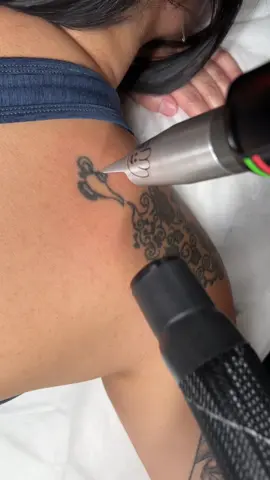 📍: CBD 0466882965 📍: WINDSOR 0466425316 👋: @swifttattooremoval 💌: swifttattooremoval.com.au  #melbournetattooremoval #tattooremovalmelbourne #tattooremovalvictoria #tattooremoval #tattoomelbourne 