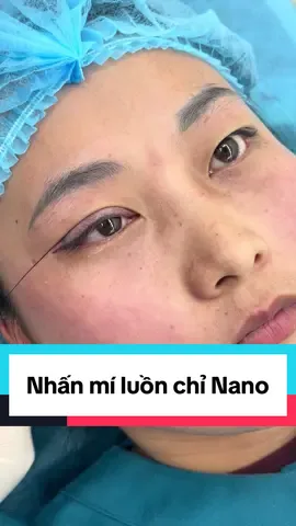 Nhấn mí luồn chỉ Nano sau 15 phút thực hiện #nhanmi #nhấnmí #nhanmitunhien #xuhuong #hair 