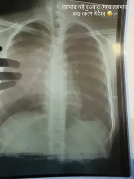 😅💔#polok_73 #outfitideas #🙏🏻respect🥺poor✊🏻videos #copylinkplease💗  @DA DU 🪦 @sifat.Taj @BANGLADESH TOP 1 @HK -A_S_H_I_K❤️‍🩹❤️‍🩹 @Omor Always On Fire @Tomal KaLa @#foryou 