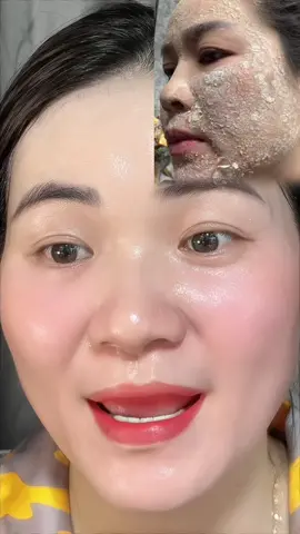 Hết nám nhờ e nó đó #thichlamdep #tannhang #nam #ilovetiktok #toiyeutiktok 