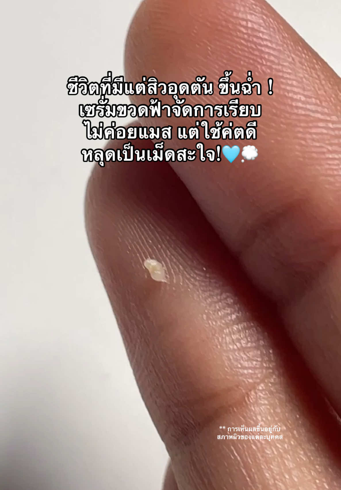 #เซรั่มละลายสิวblahmbooh #เซรั่มละลายสิวอุดตันblahmbooh #สิวอุดตัน #สิวอุดตันหาย #blahmbooh 