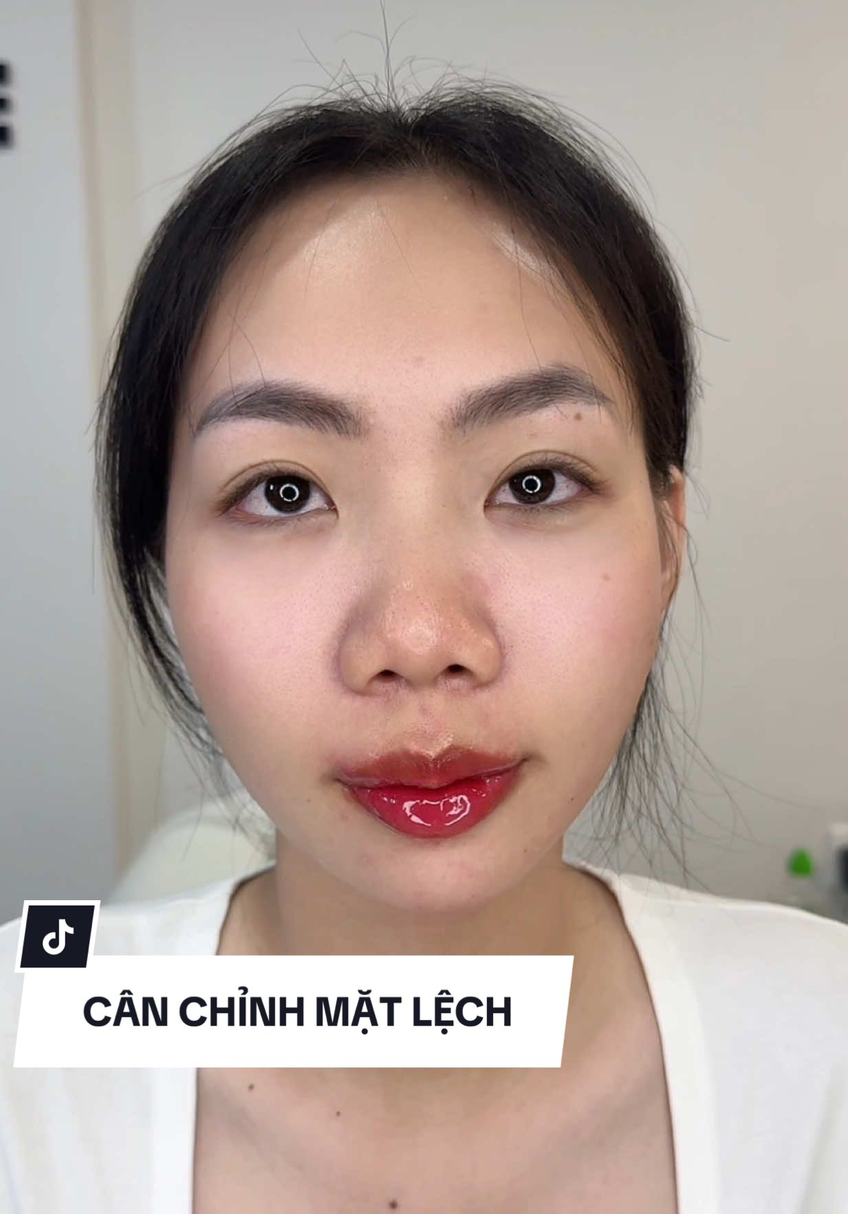 CÂN CHỈNH MẶT LỆCH tặng 1cc môi chỉ có trong tháng này ạ #fillerbinhduong #fillergovap #filler 