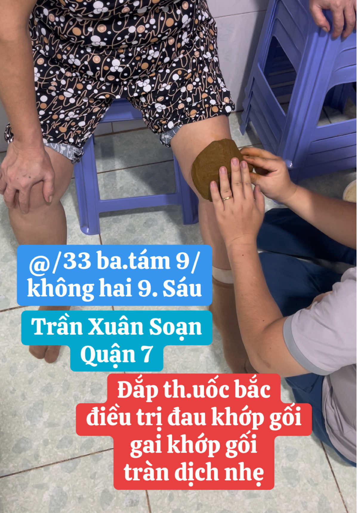 Đắp th.uốc bắc điều trị đau khớp gối, gai khớp gối tràn dịch nhẹ… #yhcthuynhngocphuoc #caodapxuongkhophuynhngocphuoc #quận7 #viemkhopgoi #daukhopgoi 