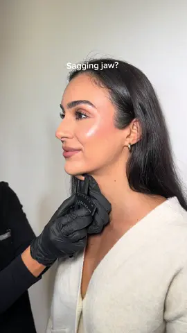 A lifted, tighter jawline without downtime. HIFU targets the deeper layers to firm and reshape the lower face. #hifu #bodysculpting #fatfreezing #perthbodysculpting #ultraformer 