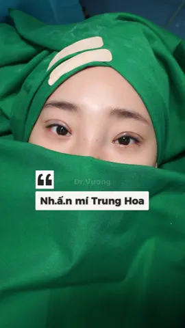 Nhấn nhẹ chiếc mí Trung Hoa để cải thiện tình trạng đa nếp mí #mitrunghoa #lamdep #drvuong #xuhuong #catmi 