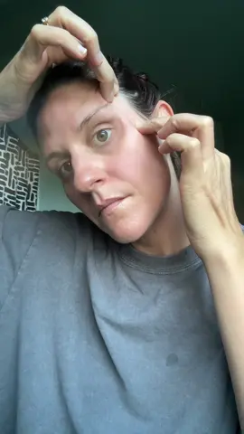 #crowsfeet #wrinkles #fyp #fypシ #fypシ゚viral 