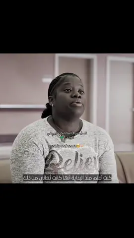 الحمدلله انسانيه بلا حدود 🇸🇦 #explore jamaican conjoined twins surgery #fyp 