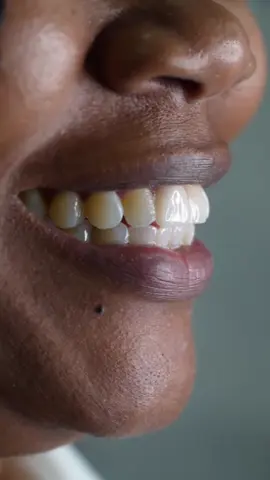 #whereyoursmilelives#abilliondollarsmile