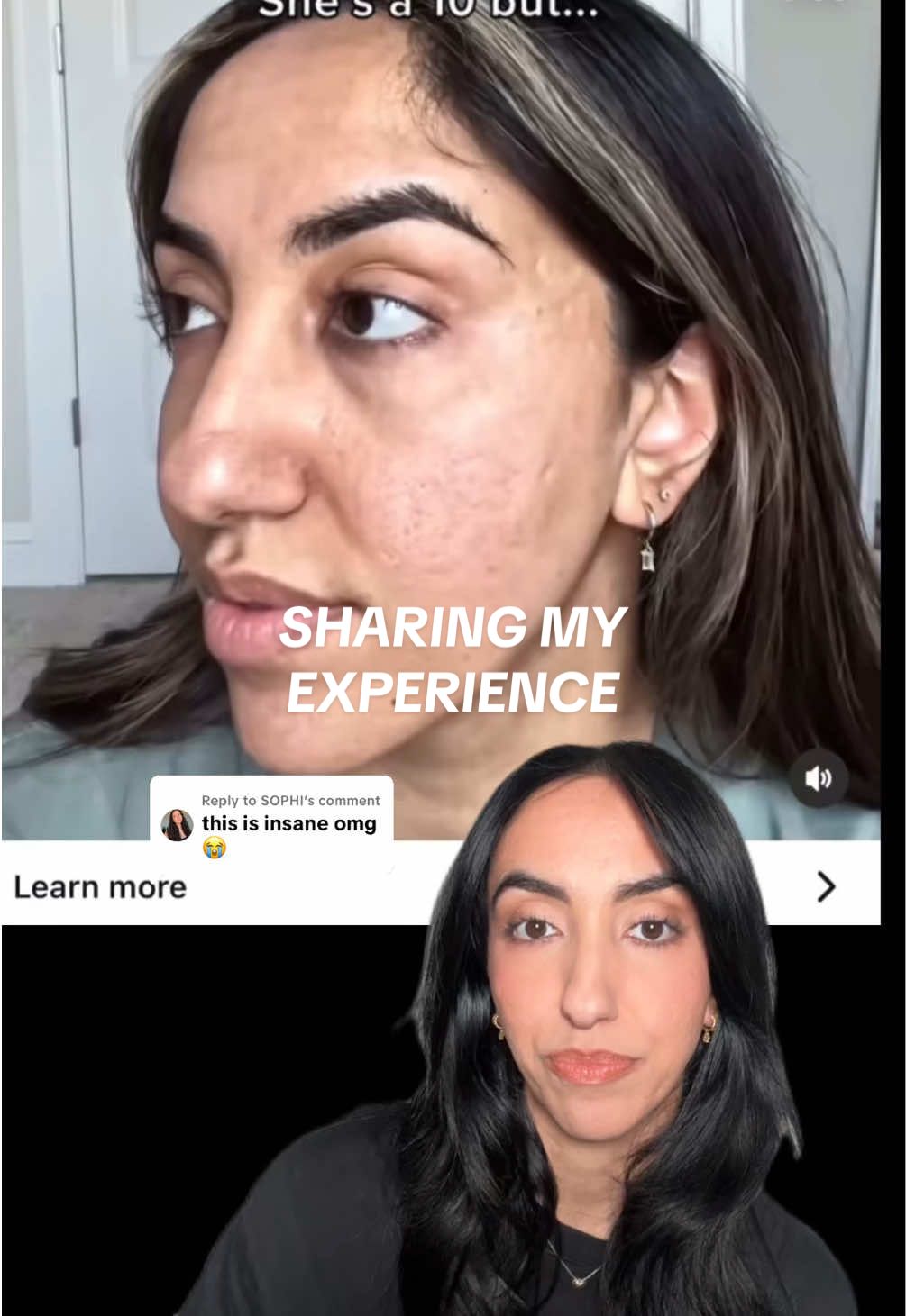 Replying to @SOPHI  Part 2 - When a brand used my face as an example of what not to do with your makeup. I just wanted to share my experience as a creator who celebrates being unfiltered and having normal skin concerns. Not fitting a certain beauty mold shouldn’t be frowned upon or used as rage bait to sell a product. All I ask for is compassion and understanding of where I’m coming from and the context I wanted to share from my experience 🫶🏼 #contentcreator #beautycreator #microinfluencer 