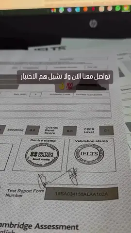 شهادة IELTS (اختصارًا لـ International English Language Testing System) هي شهادة دولية تقيس مهارات اللغة الإنجليزية للأشخاص غير الناطقين بها. تُعد واحدة من أكثر الاختبارات اعتمادًا في العالم للأغراض الأكاديمية والهجرة والعمل. مكونات الاختبار: يقيس اختبار الآيلتس أربع مهارات أساسية في اللغة:  1. الاستماع (Listening): اختبار مدته 30 دقيقة يحتوي على تسجيلات لمواقف مختلفة باللغة الإنجليزية.  2. القراءة (Reading): مدته 60 دقيقة، ويتضمن نصوصًا وأسئلة لقياس فهمك للنصوص المكتوبة.  3. الكتابة (Writing): مدته 60 دقيقة، يتطلب كتابة مقال وتقرير أو خطاب.  4. التحدث (Speaking): مقابلة شخصية مع مُقيّم تستغرق حوالي 11-14 دقيقة. أنواع اختبار الآيلتس:  1. الأكاديمي (Academic): مخصص للطلاب الذين يخططون للدراسة في الجامعات أو المؤسسات التعليمية باللغة الإنجليزية.  2. التدريب العام (General Training): موجه للأشخاص الذين ينوون الهجرة أو العمل في البلدان الناطقة بالإنجليزية. الدرجة: يتم تقييمك على مقياس من 0 إلى 9 لكل قسم، ثم يتم احتساب متوسط درجات الأقسام الأربعة للحصول على الدرجة الإجمالية من 9 أحصل الان على شهادات ايلتس IELTS مسجلة في الموقع الرسمي ‎#مبتعثين ‎#الامارات# ‎#مبتعثين_بريطانيا #مبتعثين_امريكا #مبتعثون