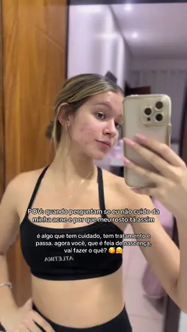 nada mais sem noção do que achar normal comentar sobre a aparência de alguém, seja corpo ou rosto. cada um sabe do próprio espelho, do próprio cuidado e do próprio processo. galera, cuidem mais da vida de vocês e menos da dos outros. 