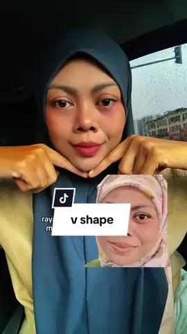 #topengmuka #vshape #jawline 