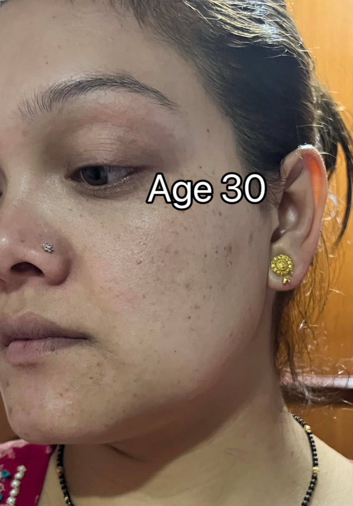 Retinal makes such a difference ❤️  @KSECRET GLOBAL  #GLOWSHOTCHALLENGE #KSECRET #SEOUL1988 #Retinal  #creatorsearchinsights 