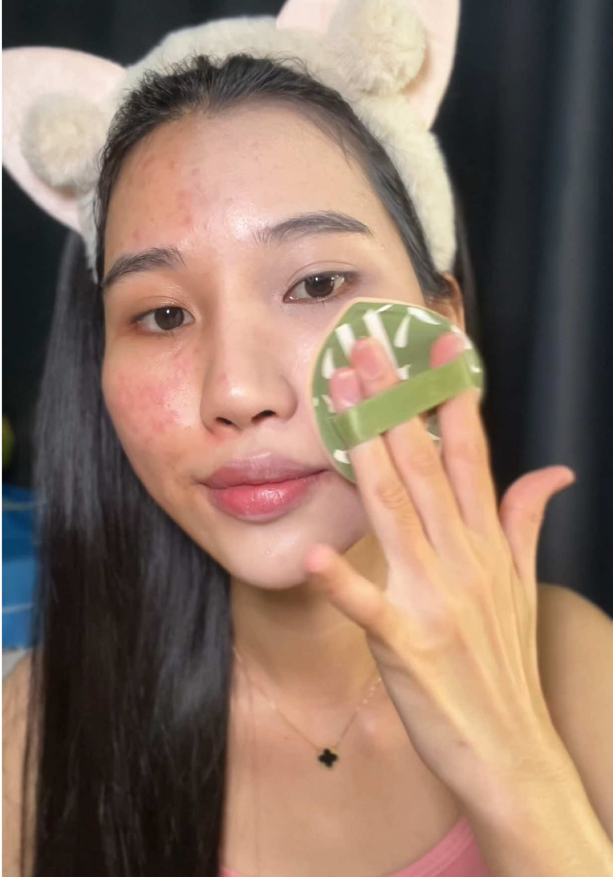 Thử dùng combo này nha mấy bà, nhã víaaa da căng bóng hết mụn, đồng mụn ơi cố gắng lên nha #Mụn #trimuntritham #trimun 