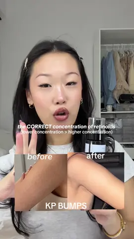 yes I’ve talked about her before and Ill talk about her again @Meditherapy Global Official retinal skin booster serum