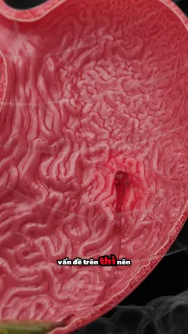 Sữa nghệ gạo lứt thuần chay #suanghegaolut #suanghegaolutthuanchay #suckhoechomoinguoi 