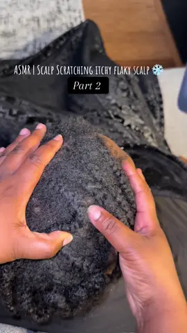 ASMR | Scalp Scratching Itchy Flaky Scalp Part 2 ✨ #asmr #asmrsounds #scalpscratching #asmrtingles #asmrtiktoks 