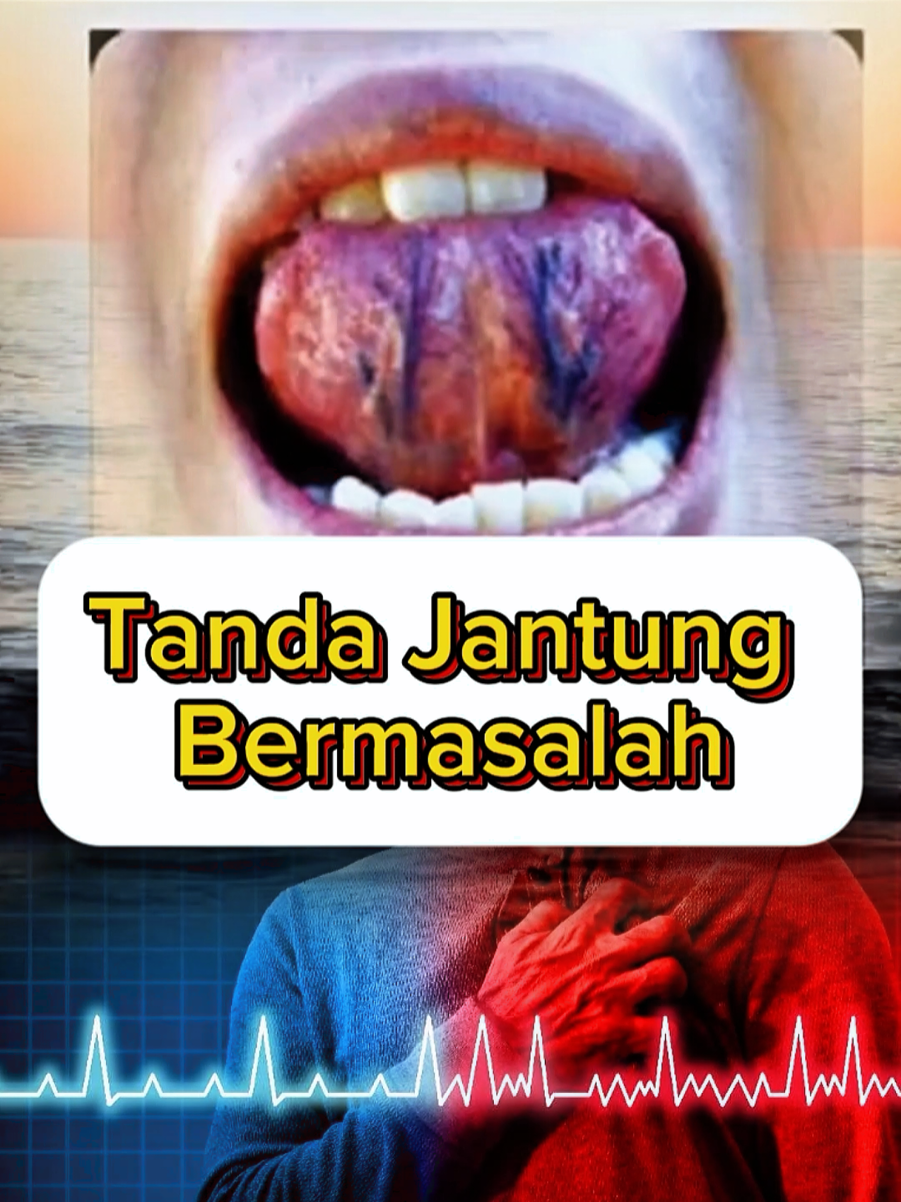 Tanda Jantung Bermasalah #Lifestyle #sehat #jantung #sakitjantung #shorts 
