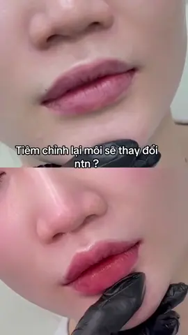 💉💉Chỉnh nhẹ dáng môi, nâng tầm nhan sắc 👄   ▪️ Tiêm môi an toàn – đẹp tự nhiên – dáng môi phù hợp với khuôn mặt  ▪️  Môi xinh tự nhiên, chuẩn dáng chuẩn from💉 #tiemmoifiller #TienLeAcademy #botox #tienleacadamy #filler 