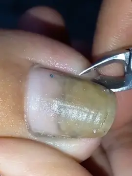 Lấy khoé siêu phê #laykhoe #laykhoemong #laykhoechan #laykhoemongchan #taovamich 