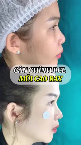 Chỉ 3🍠 có ngay MŨI CAO BAY quá đã 😝 @chi #nangmuiPCL #nangmui #collagen #muidep #Douyin  
