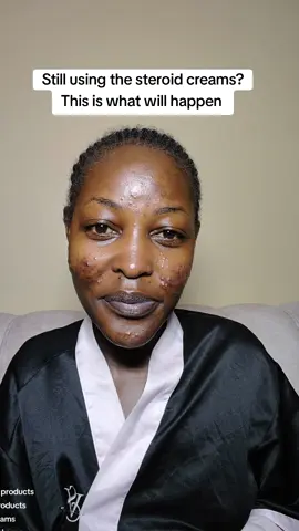 If you are using steroids creams ( betamed, betason, extraderm,medivin,elyvate ,e.t.c)  you better give me a follow because chances are your face will break out #fungalacnesafeskincare #koreanskincare #skincare #kbeautyproducts 