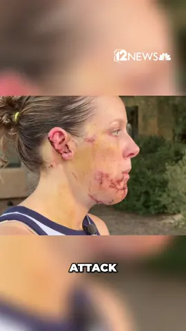 A San Tan Valley mother is recovering from a brutal dog attack and sharing a warning she hopes others take seriously: even a dog that seems gentle and familiar can become dangerous without warning.