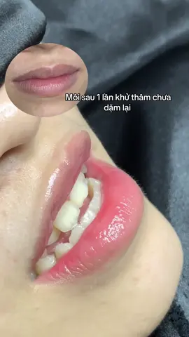 #phunmoidepthuduc #khuthammoi #phunxamtunhien #lips #mixinhpmu 