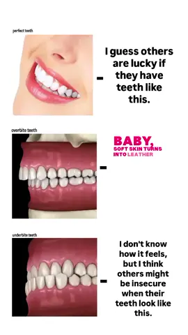 overbite teeth! #fypシ゚ #fyp #creatorsearchinsights #fypppoooopppppppppppppppppppppp #makeitviral 