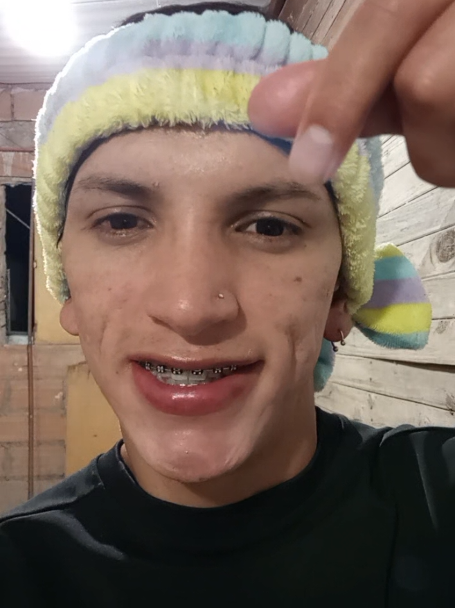 apoyen mi proceso 🥺🫰🏽#ypfッ #paratiiiiiiiiiiiiiiiiiiiiiiiiiiiiiii #rutinadeskincare #limpiezafacial #acne 