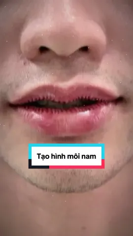 5 ngày gói gọn trong 30s. TẠO HÌNH MÔI VĨNH VIỄN