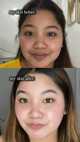 Protect your glow with SPF 50+! Stay bright,Fresh and UV Safe all day with RtopR Vitamin C Sunscreen🌸🎀🩷 #RtopR #RtopRSunscreen #VitaminC #Sunscreen #kbeauty 