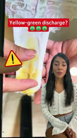 Yellow-green discharge?#womenshealth #women #discharge #probiotics #health 