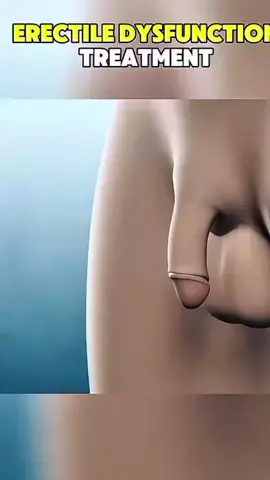 #amazing #health #video #foryou #treading 