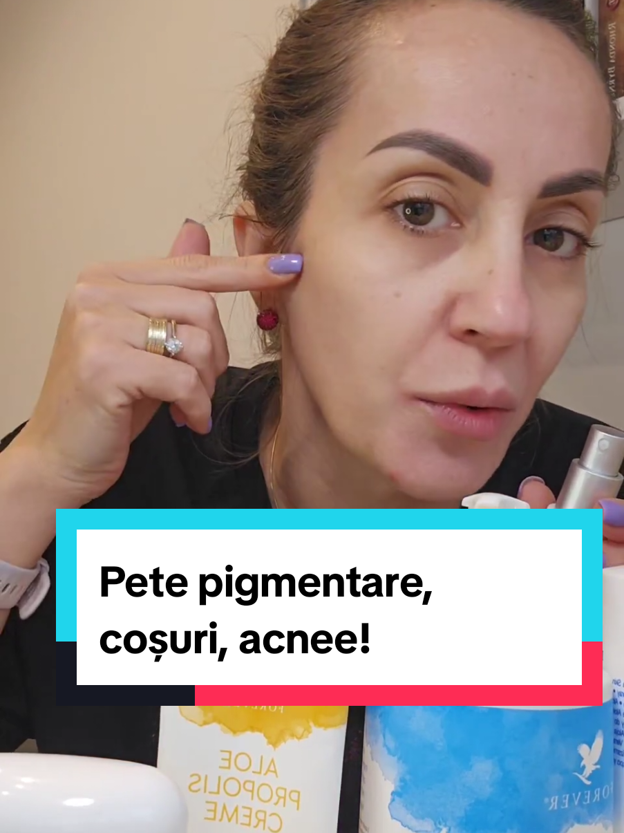 #tiktoklive #pete #acnee #iritatiialepielii #aloevera 