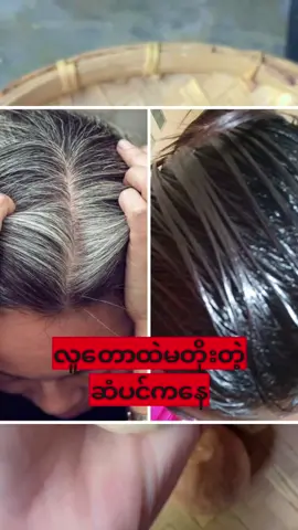 #ဆံပင်ဖြူတွေအမြစ်ပါမကျန်သက်သာပျောက်ကင်ချင်းလား#ခင်လေးဖြူ #၀၉-၉၈၁-၆၁၃-၆၅၆ မန်းလေး