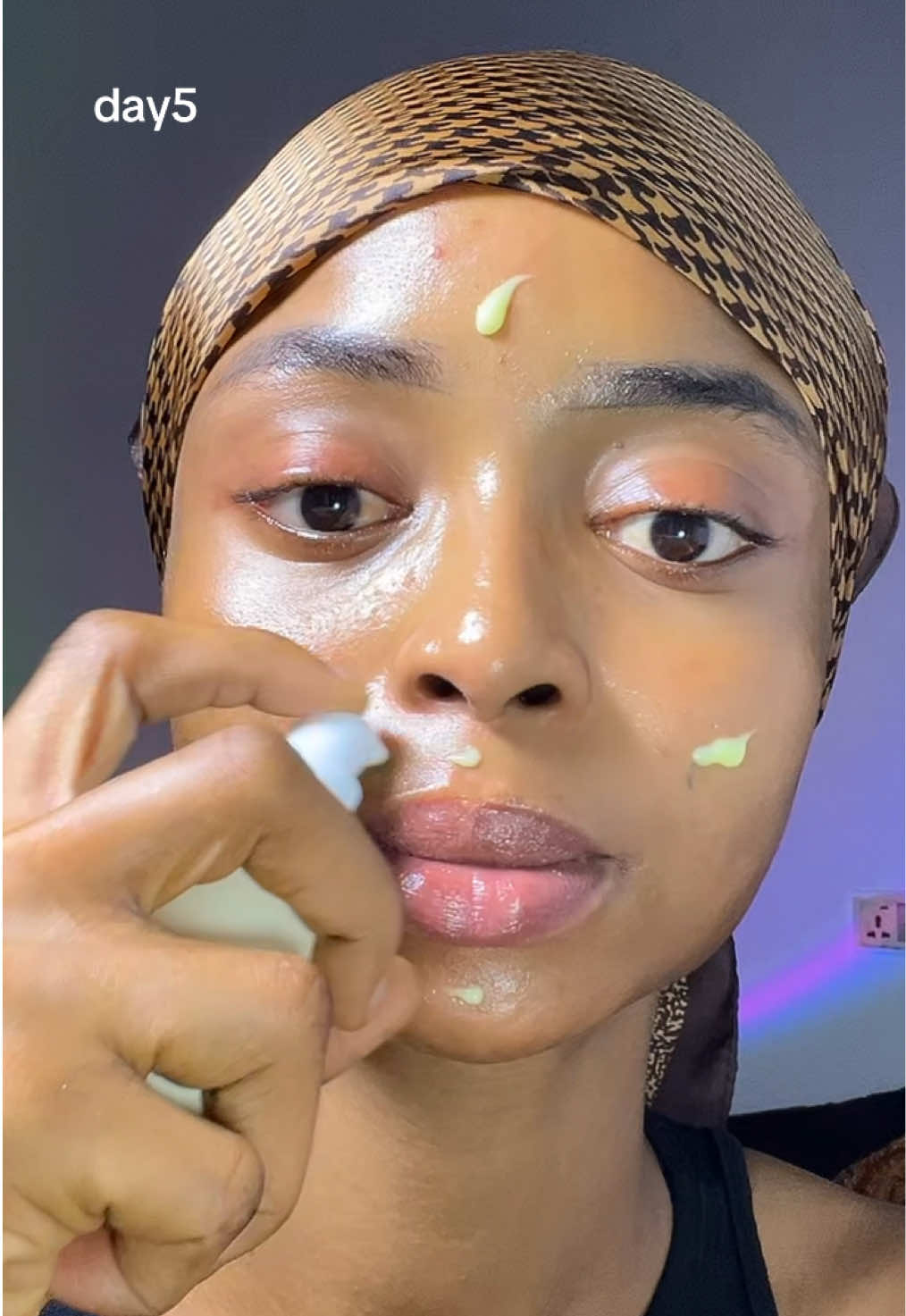 99 Problems 1 Solution #GLOWSHOTCHALLENGE #KSECRET #seoul1988 #hyperpigmentation #darkspots @KSECRET GLOBAL  