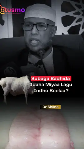 Subaga badhida idaha Indhaha miyay waxyeeleyaan #drshiine 