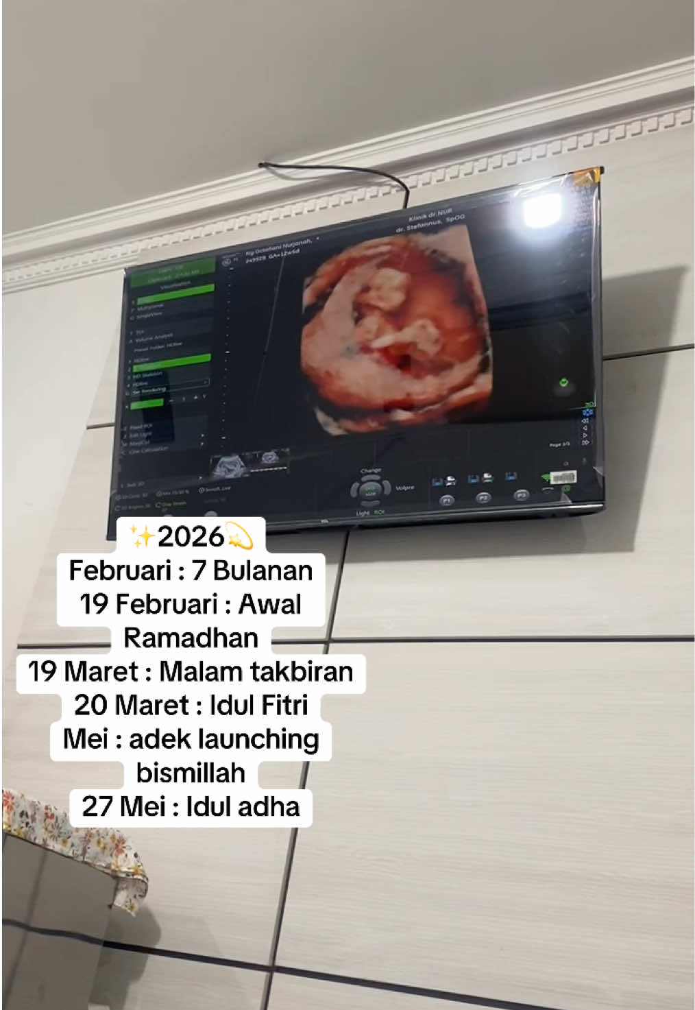 Bismillah , minta do’a terbaik yaa semuanya onty dan uncle onlinee semuanya #ramadhan2026 #wartakjil #2026 #bumilsehat 