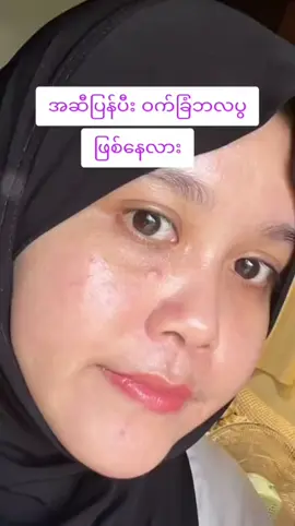 #tesoap #tiktok #foryou #ဆားဝက်ခြံပျောက်ချင်သူများအတွက် #လှိုင်သာယာကိုယ်စားလှယ် 