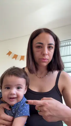 (TENGO UNA ALERGIA EN EL OJO CHIKES) Es comun que hagan eso ??? Porq me causa mucha gracia 😂😂😂 #fyp  #mamaprimeriza #bebestiktoks #maternidadereal 