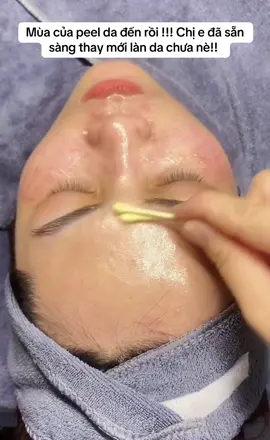 Tác dụng của peel da chị em đã biết chưa nào?? Phương pháp giúp loại bỏ tế bào chết, tái tạo da mới, Thúc đẩy collagen & elastin cho da căng bóng, khỏe mạnh ✨ Không đau – không mỏng da – an toàn tuyệt đối! ✅ Làm đều màu da, mờ thâm nám ✅ Giảm nhăn, ngừa lão hoá ✅ Da sáng mịn, khỏe từ sâu bên trong 💌 Inbox ngay để được tư vấn nha😚 #thuykieubeauty8 #spabacninh #trangda #tritham #xuhuong 