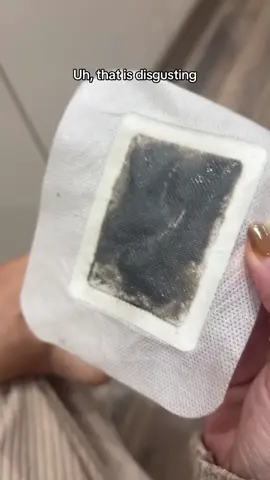 I have no words! 🤢 #detox #detoxfootpatches #tiktokmademebuyit #toxins 